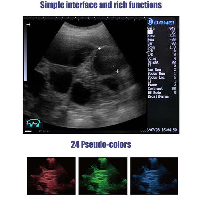 Portable Veterinary Ultrasound Scanner for Pig Sheep Cattle Horse Dog